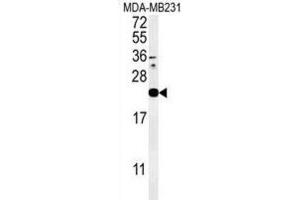 Western Blotting (WB) image for anti-Interleukin 1 Family, Member 6 (IL1F6) antibody (ABIN3002274) (IL36A/IL1F6 antibody)