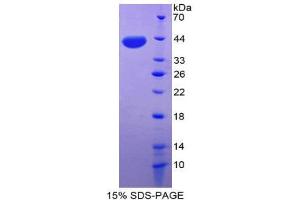 SDS-PAGE (SDS) image for Orexin A (OXA) (AA 32-123) protein (His tag,GST tag) (ABIN2123425)