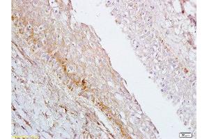 Formalin-fixed and paraffin embedded rat ovary tissue labeled with Anti-AGPAT4 Polyclonal Antibody, Unconjugated  at 1:200 followed by conjugation to the secondary antibody, (SP-0023), and DAB staining (AGPAT4 antibody  (AA 231-330))