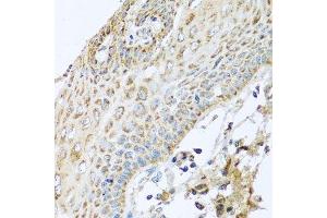 Immunohistochemistry of paraffin-embedded human esophagus using NDUFA2 antibody. (NDUFA2 antibody  (AA 1-95))