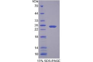 SDS-PAGE (SDS) image for Lectin, Galactoside-Binding, Soluble, 3 Binding Protein (LGALS3BP) ELISA Kit (ABIN6730946)