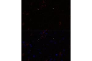 Immunofluorescence analysis of rat brain using KIF17 antibody (ABIN7268123) at dilution of 1:100.