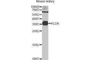Western blot analysis of extracts of mouse kidney, using PECR Antibody (ABIN2564466) at 1:1000 dilution. (PECR antibody)