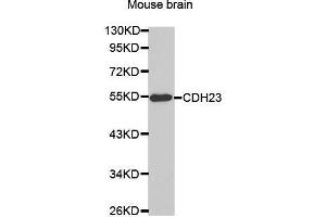 Western Blotting (WB) image for anti-Cadherin 23 (CDH23) antibody (ABIN3016687) (CDH23 antibody)