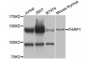 Western blot analysis of extracts of various cell lines, using PARP1 antibody (ABIN5998456) at 1/1000 dilution. (PARP1 antibody)