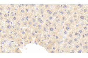 Detection of IGF1 in Mouse Liver Tissue using Polyclonal Antibody to Insulin Like Growth Factor 1 (IGF1) (IGF1 antibody  (AA 49-153))