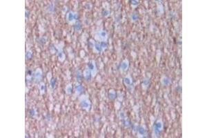 IHC-P analysis of Human Tissue, with DAB staining. (BAMBI antibody  (AA 29-130))
