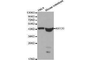 Western blot analysis of extracts of various cell lines, using KRT20 antibody. (KRT20 antibody  (AA 245-424))