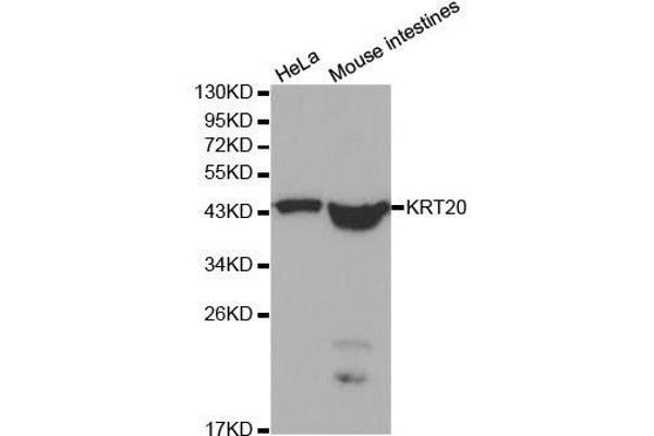 KRT20 antibody  (AA 245-424)