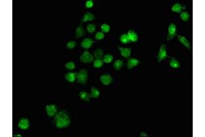 Immunofluorescence staining of PC-3 cells with ABIN7163013 at 1:100, counter-stained with DAPI. (PPARG antibody  (AA 1-477))