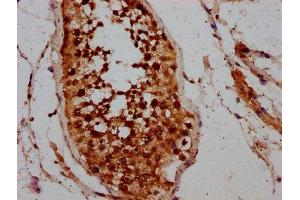 IHC image of ABIN7146463 diluted at 1:200 and staining in paraffin-embedded human testis tissue performed on a Leica BondTM system. (Calicin antibody  (AA 240-351))