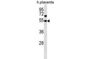 Western Blotting (WB) image for anti-Sorting Nexin Family Member 30 (SNX30) antibody (ABIN3000293) (SNX30 antibody)