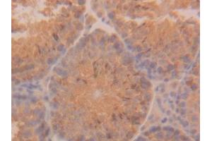 Immunohistochemistry (IHC) image for anti-Keratin 18 (KRT18) (AA 1-423) antibody (ABIN7437488)