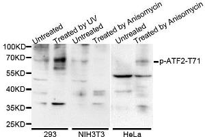 Western blot analysis of extracts of various cells, using Phospho-ATF2-T71 antibody (ABIN5969881).