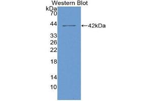 Western Blotting (WB) image for anti-Colony Stimulating Factor 2 Receptor, Alpha, Low-Affinity (Granulocyte-Macrophage) (CSF2RA) (AA 28-112) antibody (ABIN1867408) (CSF2RA antibody  (AA 28-112))