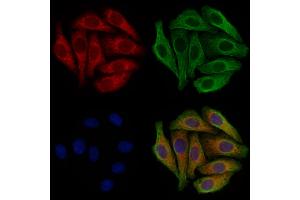 ABIN6262010 and ABIN6277327 staining Hela cells by IF/ICC. (GNAS antibody  (N-Term))