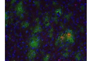 Indirect immunostaining of a PFA fixed formic acid treated brain section from a triple transgenic Alzheimer´s disease mouse with anti-Abeta 40 (dilution 1 : 500; red) and rabbit anti-Abeta (, dilution 1 : 500; green).