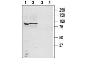 Western blot analysis of human PC3 Caucasian prostate adenocarcinoma (lanes 1 and 3) and human LNCaP prostate carcinoma (lanes 2 and 4) cell lysates: - 1,3. (TRPC4 antibody  (C-Term, Intracellular))