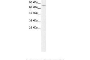 Image no. 2 for anti-Endoglin (ENG) (AA 61-110) antibody (ABIN202837) (Endoglin antibody  (AA 61-110))