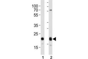 Western blot analysis of lysate from (1) HeLa and (2) MCF-7 cell line using CD9 antibody at 1:1000. (CD9 antibody  (AA 115-145))