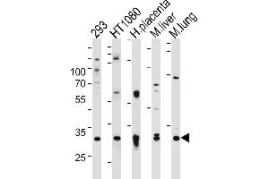 Western blot analysis of lysates from 293,HT1080 cell line,human placenta,mouse liver and lung tissue (from left to right),using SAR1A Antibody . (SAR1A antibody  (AA 122-149))