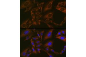 Immunofluorescence analysis of U-2 OS cells using BMP6 Rabbit mAb (ABIN7265900) at dilution of 1:100 (40x lens). (BMP6 antibody)