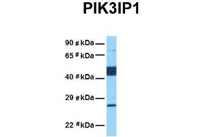 Host:  Rabbit  Target Name:  PIK3IP1  Sample Tissue:  Human Lung Tumor  Antibody Dilution:  1. (PIK3IP1 antibody  (Middle Region))