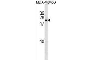 ZN Antibody (Center) (ABIN1538689 and ABIN2850066) western blot analysis in MDA-M cell line lysates (35 μg/lane). (ZNF580 antibody  (AA 91-119))