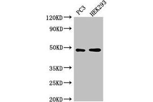 Western Blot Positive WB detected in: PC-3 whole cell lysate, HEK293 whole cell lysate All lanes: ACTR10 antibody at 3 μg/mL Secondary Goat polyclonal to rabbit IgG at 1/50000 dilution Predicted band size: 47 kDa Observed band size: 47 kDa (ACTR1 antibody  (AA 165-417))
