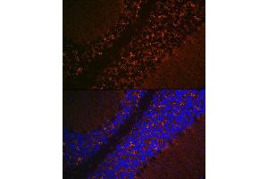 Immunofluorescence analysis of mouse brain using SLC17 Rabbit pAb (ABIN7270407) at dilution of 1:100 (40x lens). (Solute Carrier Family 17 (Vesicular Glutamate Transporter), Member 6 (SLC17A6) (C-Term) antibody)