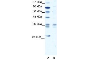 WB Suggested Anti-BARX1 Antibody   Titration: 1.