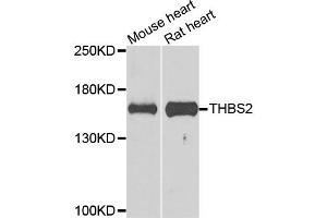 Western blot analysis of extracts of various cell lines, using THBS2 antibody. (Thrombospondin 2 antibody)