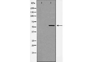 Western blot analysis of ANG 2 Antibody expression in Rat kidney tissue lysates.