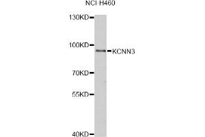 Western blot analysis of extracts of NCI-H460 cells, using KCNN3 antibody (ABIN1877111) at 1:1000 dilution. (KCNN3 antibody)