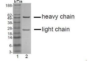 SDS-PAGE (SDS) image for anti-Botulinum Neurotoxin Type B (BoNT/B) antibody (ABIN179725)