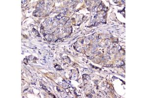 Immunohistochemistry (IHC) image for anti-Dynamin 1 (DNM1) antibody (ABIN5647109)