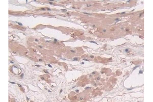 Transgelin antibody  (AA 1-201)