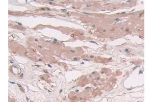 Detection of TAGLN in Human Prostate Tissue using Polyclonal Antibody to Transgelin (TAGLN) (Transgelin antibody  (AA 1-201))