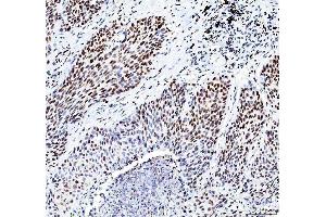 IHC analysis of HDAC2 using anti-HDAC2 antibody (ABIN7601564).