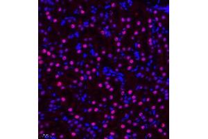 Immunofluorescence of paraffin embedded mouse kidney using ZHX3 (ABIN7076287) at dilution of 1:650 (400x lens) (ZHX3 antibody)