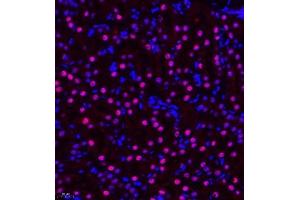 Immunofluorescence of paraffin embedded mouse kidney using ZHX3 (ABIN7076287) at dilution of 1:650 (400x lens)