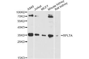Western blot analysis of extracts of various cell lines, using RPL7A antibody (ABIN6290895) at 1:3000 dilution.