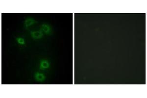 Immunofluorescence analysis of A549 cells, using BMX antibody. (BMX antibody  (N-Term))