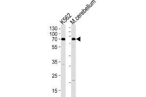Western Blotting (WB) image for anti-EPM2A (Laforin) Interacting Protein 1 (EPM2AIP1) antibody (ABIN3004753) (EPM2AIP1 antibody)