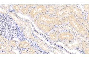 Detection of LCN12 in Human Kidney Tissue using Polyclonal Antibody to Lipocalin 12 (LCN12) (LCN12 antibody  (AA 61-184))
