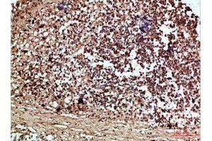Immunohistochemical analysis of paraffin-embedded human-thyroid, antibody was diluted at 1:200 (RCC1 antibody  (AA 301-350))