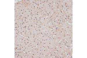 Immunohistochemistry (IHC) image for anti-Tousled-Like Kinase 1 (TLK1) (AA 160-230) antibody (ABIN7270859)