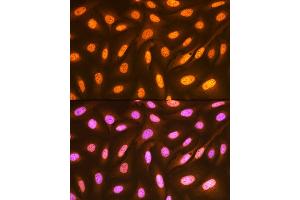 Immunofluorescence analysis of U-2 OS cells using FUBP1 Rabbit mAb (ABIN7267128) at dilution of 1:100 (40x lens). (FUBP1 antibody)