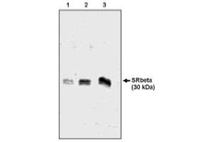 Image no. 1 for anti-Signal Recognition Particle Receptor, B Subunit (SRPRB) (AA 246-265) antibody (ABIN265297) (SRPRB antibody  (AA 246-265))