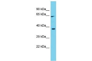 Host: Rabbit  Target Name: Cyp1b1  Sample Tissue: Rat Testis lysates  Antibody Dilution: 1.